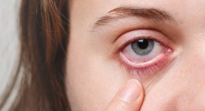 Deslocamento de Retina: Existe tratamento sem cirurgia?